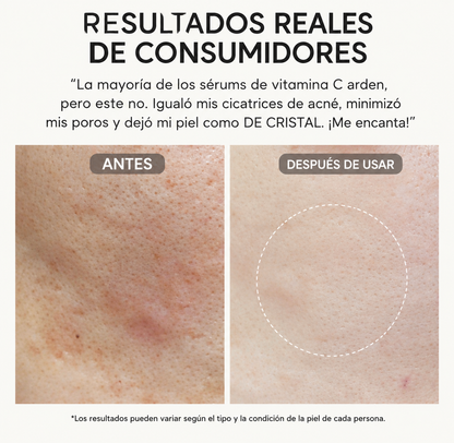 ✨ARENCIA,  Potente Sérum de Vitamina C  ✨